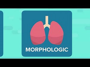 Interstitial Pneumonia with Autoimmune Features