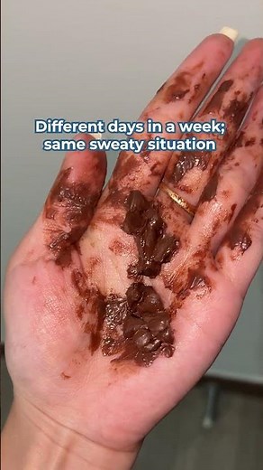 When excessive sweating follows you every day, it could be hyperhidrosis