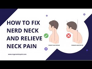 How to Fix Nerd Neck and Relieve Neck Pain | Simple Stretches & Posture Tips