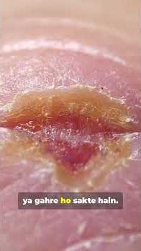 🔥 “Why Some Facial Scars Never Fade – The Science Your Doctor Won’t Tell You!”