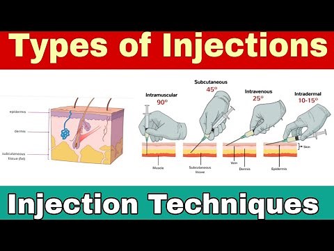 Types of Injections and different techniques. Must know