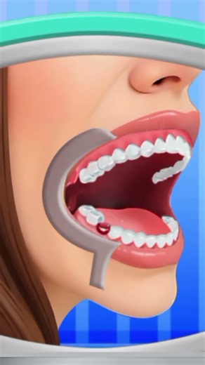 ​🦷 Tooth Extraction Procedure Animation | Dental Care Step-by-Step 😲💉