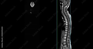 MRI whole body scans are beneficial for early cancer detection, monitoring chronic conditions, and overall health assessments.