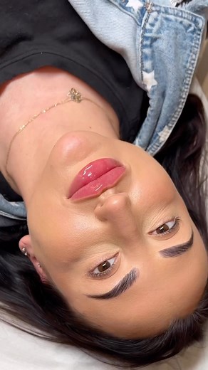 Russian lips on Instagram: "Lips that makes you go wow 🤩 gorgeous, sexy lips using 2 up to 3 ML to achieve this results. this was the first treatment following previous dissolving, which was a week ago. At some point we all need to reverse old Fillers as overtime. The filler can move and change within the body along with the technique and differences are used. reserve your appointment 3109193212 #lips#lipfiller #botox#lipo#plasticsurgery #medspa"