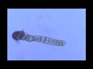 33. Sexual Reproduction in Ferns (Pteridium aquilinum, Anemia phyllitidis)