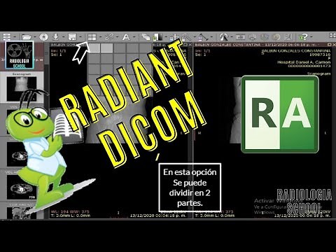 ✅Tutorial de funcionamiento RADIANT DICOM visualizador de imágenes medicas (RADIOGRAFIAS)