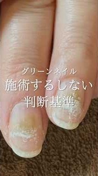 グリーンネイル 施術するしない判断基準