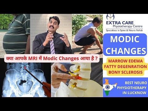 MODIC CHANGES in Lower BACK | Lumbar Spine MRI | Disc Degeneration & Endplate Changes