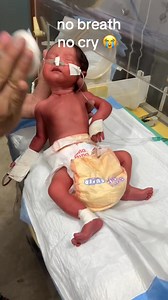 139K views · 965 reactions | no breath no cry  please pray for baby #baby #newborn #prayforbaby | New Born Baby | Facebook