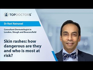 Skin rashes: how dangerous are they and who is most at risk? - Online interview
