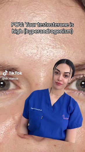 Treatment for patients with acne includes topical antiacne agents, oral antibiotics such as tetracycline, antiandrogens (hormone therapy, including birth control pill) and oral isotretinoin. These can be used successfully in patients with and without hyperandrogenism. Most women with hirsutism use physical methods of hair removal and may take the birth control pill. However, when acne and/or hirsutism are unresponsive to conventional therapy because of hormone imbalances, more potent antiandroge