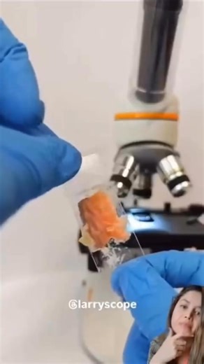 SUSHI = PARASITES 🐛😭 Eating raw fish—even so-called “sushi-grade”—comes with a disturbing risk: parasites. One of the most common? Anisakis simplex, a parasitic worm found in marine fish. According to the CDC and NIH, Anisakis can cause a condition called anisakiasis—where the larvae burrow into your stomach or intestinal lining, causing: ◼ Severe abdominal pain ◼ Nausea and vomiting ◼ Diarrhea or constipation ◼ Allergic reactions (even anaphylaxis) Even freezing doesn’t guarantee full protect