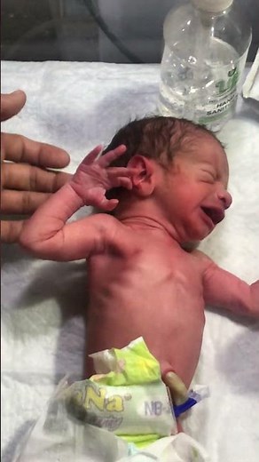 One of Twin Babies’ First Cute Cry | Beautiful Neonatal Moment 💕