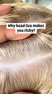 51K views · 51 reactions | Why head lice makes you itchy l lice removal #momlife #hair #school #piojos #explore | Stacey The Louse Lady | Facebook