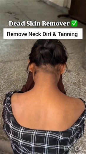 Dead Skin Remover Best Cream | DIY Skin Lightening Mask#haircare #skincare #tips #diy #bright#viral