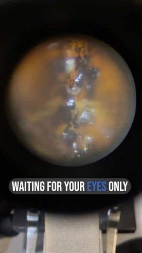 The bottom of the pear👀🔬under microscope