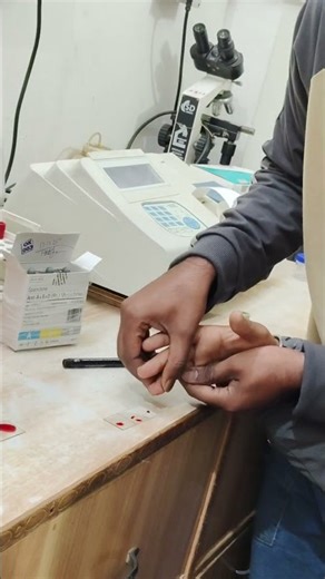 #blood group test is a simple test ABO type (A, B, AB, O) and Rh factor (+ or −).#post #viralvideo