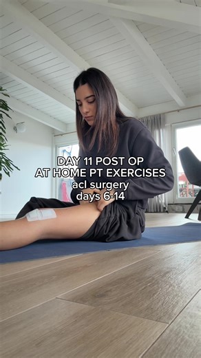 Post-ACL Surgery Exercise Journey