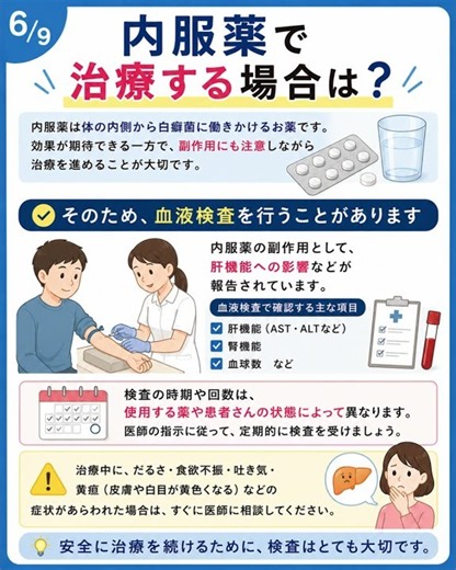 【水虫薬一筋５０年の大源製薬】爪水虫の診断＆治療方法について #爪水虫 #ネイルケア #水虫 #爪の変色 #大源製薬