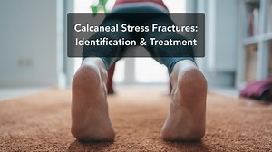 Calcaneal stress fractures: Identification and treatment - RunningPhysio