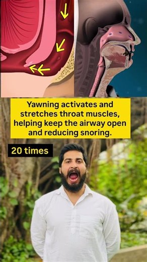 Fix snoring 😴 |#snoring