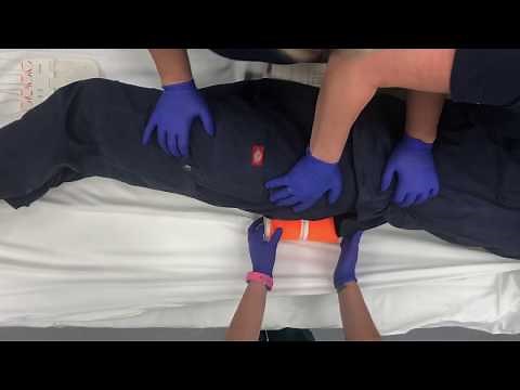 Trauma in a Flash: Pelvic Fractures