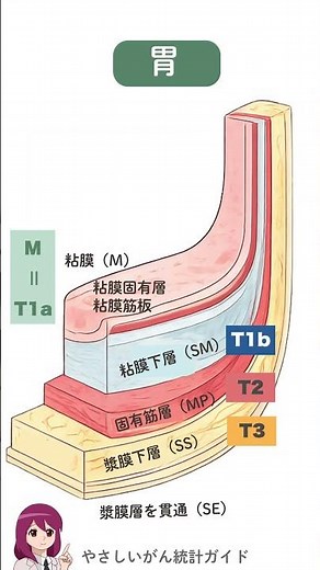 食道と胃、壁構造のちがい｜がん登録中級