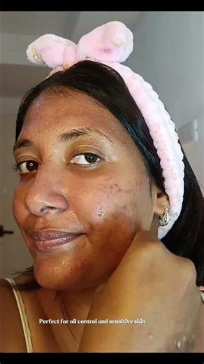 Dile adiós al brillo facial! 🍵 El Green Tea Fresh Toner de ‪@isntree_official‬