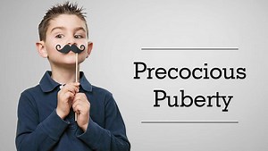 Precocious Puberty - Early Onset Puberty - Causes, Signs, Treatment