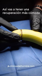 ¿Conoces el método de circuncisión con laser? Se realiza en menos tiempo, con menos dolor y con un corte más estético. 🧑🏻‍⚕️ Agenda una consulta con nuestro urólogo especialista en Clinicasdelhombre.com | Clínicas del Hombre