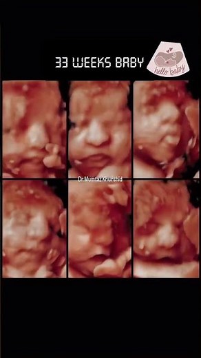 Pregnancy Ultrasound at 33 Weeks