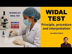 Widal test: indications & interpretations
