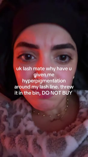 chat is this reversible #uklash