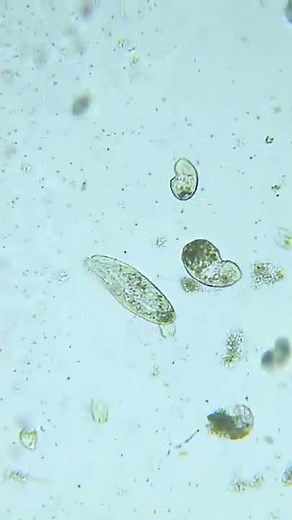 MUCUS UNDER THE MICROSCOPE 🔬