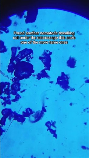 Nematode under the microscope 🔬