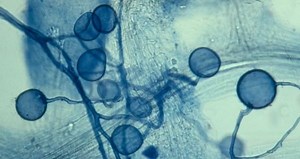 Glomeromycota ~ Everything You Need to Know with Photos | Videos