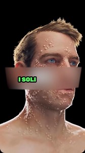 129K views · 9.6K reactions | Šta nam sve priroda nudi? 狼 • • • • • #healthy #health #healthyfood #healthcoach #healthiswealth #natural #naturalremedy #healthylifestyle | NaturaMedy | Facebook