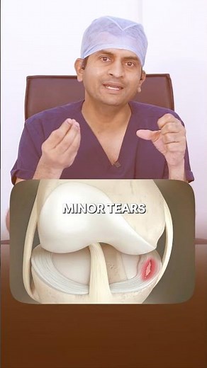 Meniscus Tear Explained | Dr. Sharath Babu