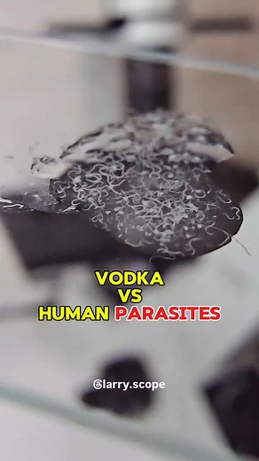 Absolut Vodka under the microscope 🔬 #diaryofamedlabstudent #fbreelsfypシ゚viralfbreelsfypシ゚viral #liberianinindia #highlights2025 #friendlyᥫᩣシ #followerseveryonehighlights #followersreelsfypシ゚viralシfypシ゚viralシalシ #highlightseveryone #medlabfinds #hilightseveryonefollowers2025 #everyone #everyonefollowers #followersreels #followerseveryone | Diary of a MedLab Student