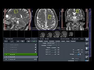 Spectroscopy MRI SVS and CSI
