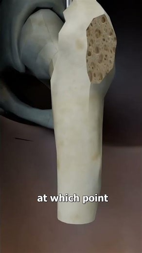 height growth,growth hormone,3d animation#height #viral #taller #acchive dream height#3d animation