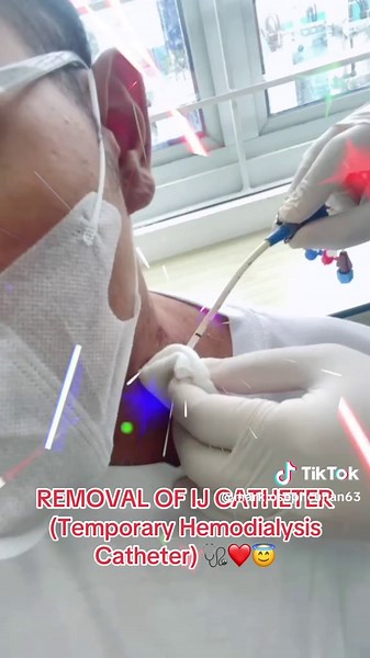 IJ Catheter Removal for Dialysis Patients Explained