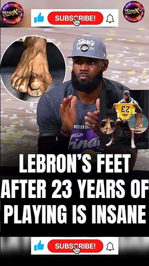 LeBron’s Feet After 23 Years in NBA Are INSANE 😱 #LeBronJames #lebronjr #funny