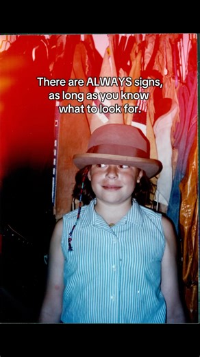 A burn, ONE, on a child, could be from numerous innocent things. A bruise, or even a couple, on a young child’s shins is normal. Perhaps, a child without bruises on their shins, is ABNORMAL. Scratches on a child, could be from playing. And, accidents happen. However, multiple bruises (quantity and location matter), on suspicious locations, needs to be questioned. How does a child even get a bruise on their armpit, while “playing”. *I can’t remember this specific moment, but how did I get “armpit