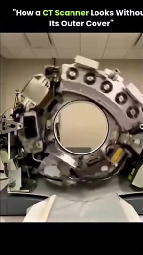 CT scan without outer cover😱#didyouknow #facts #machine #nevergiveup #shortsfeed #viral #tranding ##