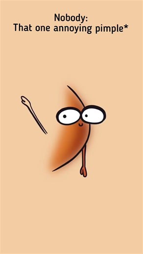 Jab Ek Pimple Puri Zindagi Pareshan Kar De 😤😂 | #cartoon #pimple #shorts #funny #animation #lakh