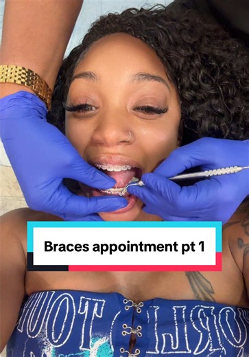 Braces Appointment Pt 1: Braces Color Change Ideas