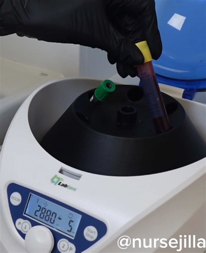 PRP Microneedling Quick Breakdown ✨ PRP microneedling combines tiny skin renewing micro injuries with your own platelet rich plasma to boost healing and collagen. How it works: 1️⃣ We take a small blood sample. 2️⃣ Spin it to separate the PRP (liquid gold). 3️⃣ Microneedling creates micro channels. 4️⃣ PRP is applied so it absorbs deeply. Why it’s amazing: ✨ Stimulates collagen ✨ Smooths texture   acne scars ✨ Brightens   evens tone ✨ Softens fine lines ✨ 100% natural as it uses your own plasma 