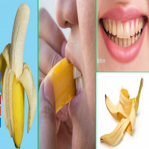 Here's how to use banana peels to whiten your teeth. You'll need one banana peel, a toothbrush, and some toothpaste: Rub the underside of the banana peel all over your teeth. Once your teeth have been thoroughly rubbed, let the banana matter sit on your teeth for ten minutes | Health Tips