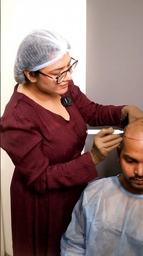 Watch the Exact Hairline Design Process
